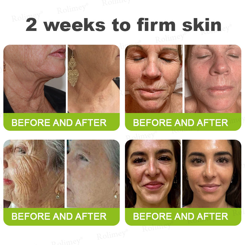 🍃Rolimey®Wrinkle-Lift Tightening stick